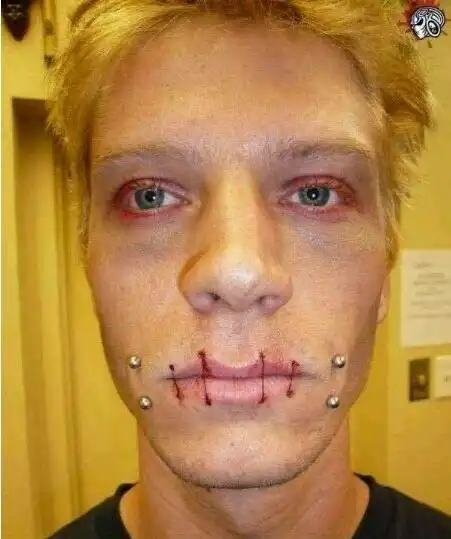 世界上最恐怖的手术分舌手术最吓人将舌头分成两半