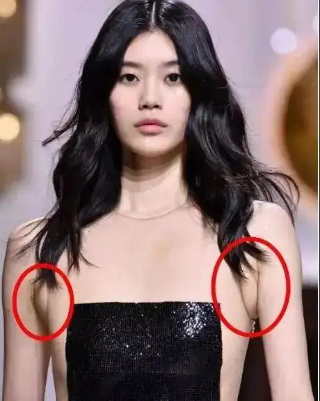 百花奖上艳惊全场的佟丽娅被它抢镜,虞书欣要求记者p掉它,副乳是个什