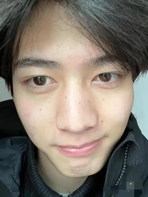 这还是男版杨超越甘望星素颜怼脸自拍瑕疵明显判若两人