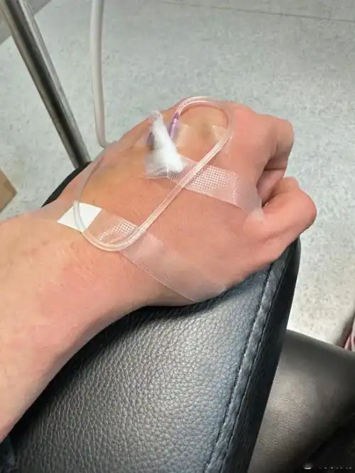 黄晓明假期饮食太放纵导致肠胃炎和急性荨麻疹晒输液照引心疼