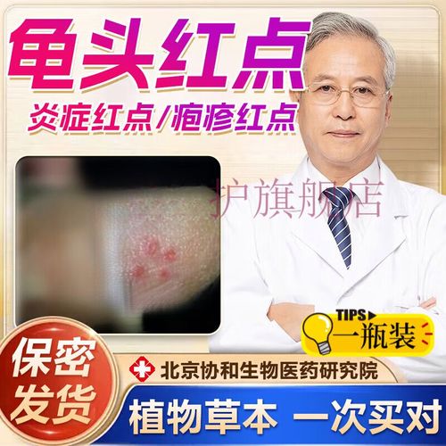 熏姿颜龟头红点包皮瘙痒有小红点斑红肿裂口脱皮瘙痒真菌感染霉菌性