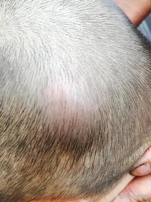 在宝宝的成长过程中,会出现许许多多的症状,所以妈妈们一定要提高警惕