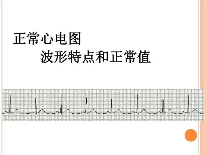 正常心电图 波形特点和正常值
