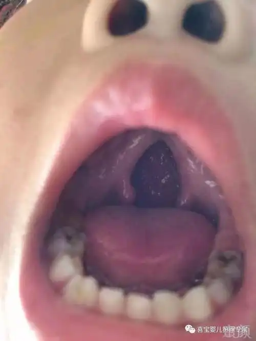 请不要遗弃唇腭裂的宝宝,发挥社会正能量!