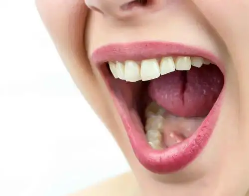 鲜为人知的癌症口腔癌