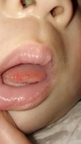 分享到:  2015-03-17 15:29  提问者采纳  热心网友 上火够大的啊