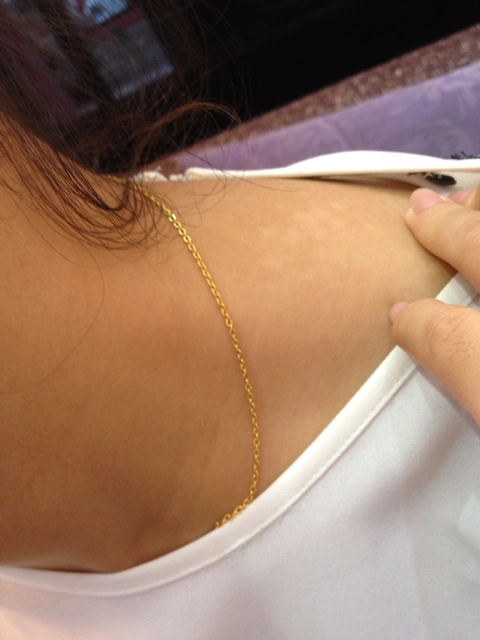 脖子长了花斑癣 - 小夫妻 - 妈妈帮