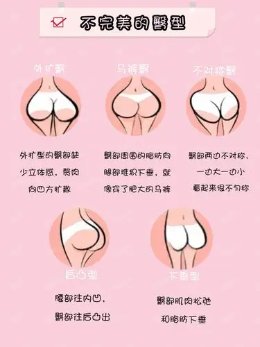 想做臀部塑型都有哪几种方法呢