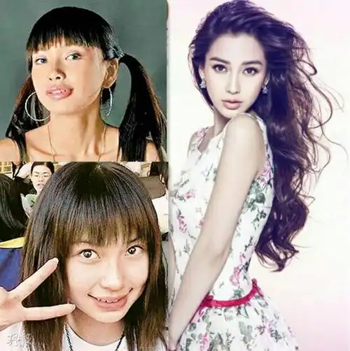 angelababy整容前后照片