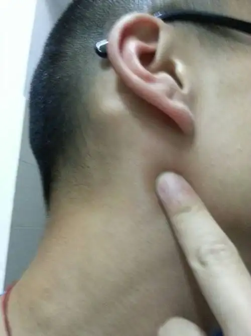 耳根后面长了个什么,摸着像骨头,感觉有点