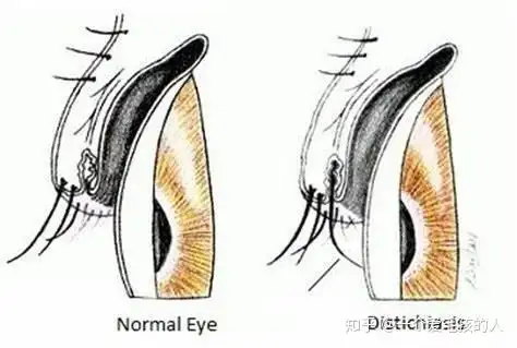 柴犬泪眼汪汪其实是睫毛倒插长