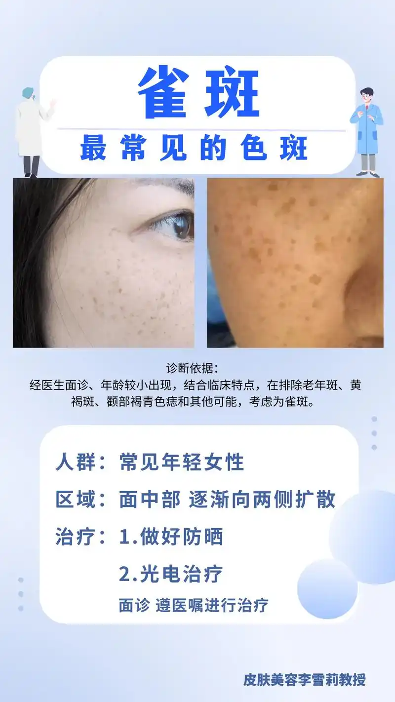 最常见的斑,你能区分了吗?#黄褐斑 #老年斑 #雀斑 #颧 - 抖音
