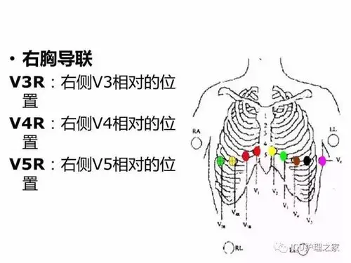 心电图机的操作12导联18导联链接详解