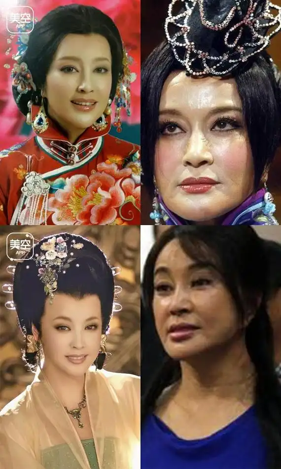 郑爽嘴歪李小璐面瘫,盘点娱乐圈整容失败女星