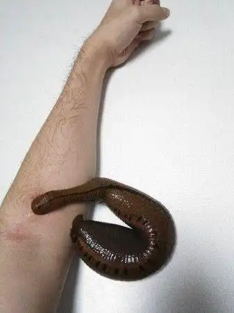 印度直到现在还有用水蛭吸血治病的疗法!