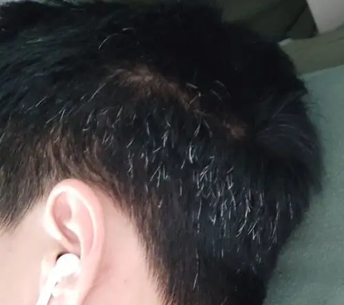 我这白头发算多吗?