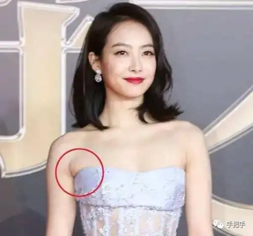 【养生】副乳你不当回事, 非要等到乳腺癌,淋巴癌吗? | 手把手