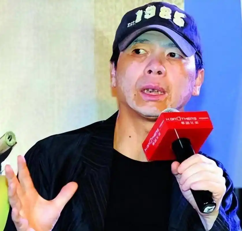 冯小刚,白癜风竟然全好了!