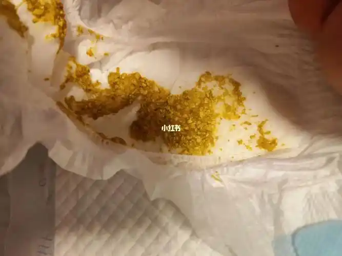 宝宝吃奶粉大便奶瓣多正常吗