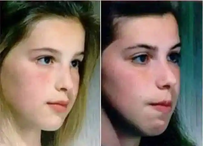 小儿腺样体肥大_介绍_治疗方式 - 好大夫在线