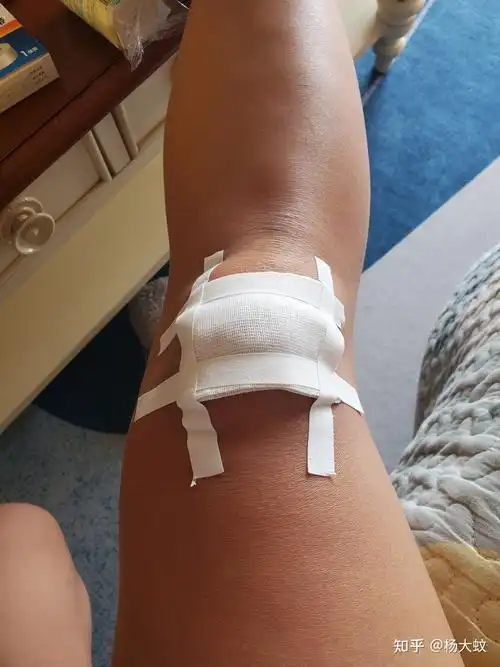 然后回家自己用碘伏消毒了一下,自己用纱布包扎好,开启了躺平的一天