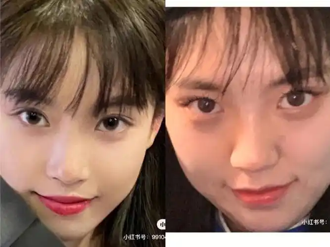 拿着半藏森林照片做的双眼皮