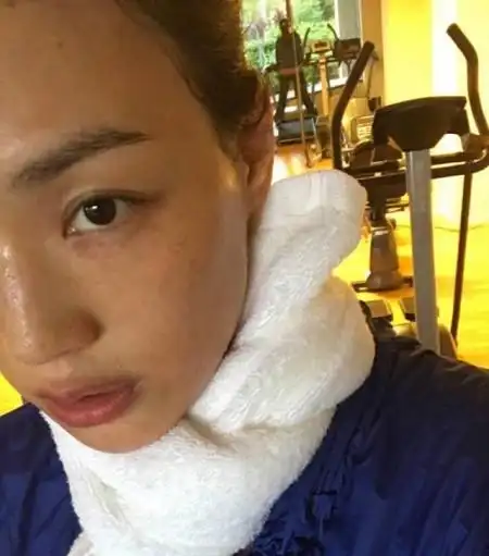 刘涛真素颜"脸黄",舒淇雀斑更明显,女生到底如何美白才有效?