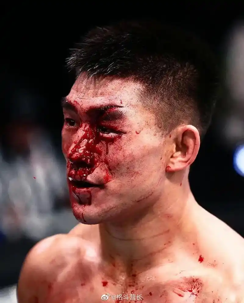 看到宋亚东血撒八角笼,医生叫停比赛遗憾告负,心痛