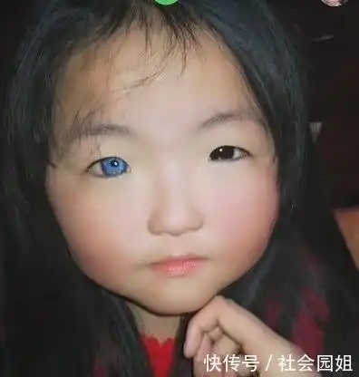 女孩天生"异瞳"走红,睁开眼那时,网友:动漫萝莉!