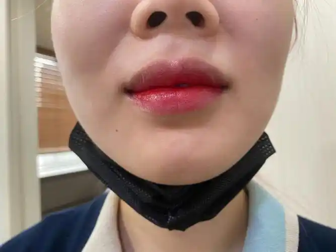 韩国纹唇工作日常纹唇第二天