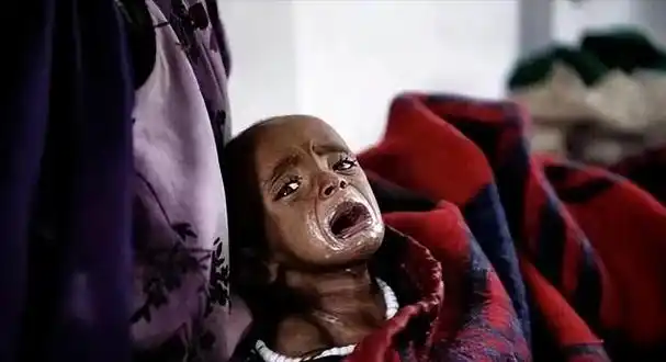 2016年,非洲1岁男童被遗弃街头.如今,他还活着吗