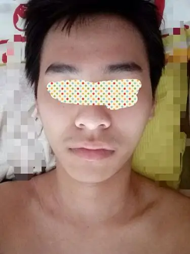 下巴是不是歪了?