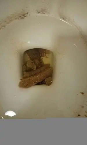 这个大便,就是黄金便