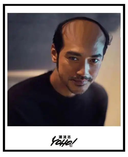 太秃然了贝克汉姆都逃不过的秃头命运我还能怎么办