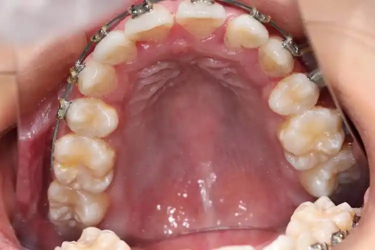 成都高新兴天康牙科诊所