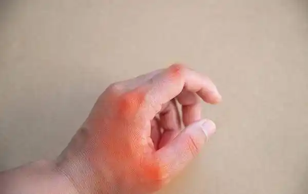 手指关节总是疼痛,或与这5个原因有关,问题可大可小,需重视