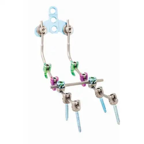 女高音颈椎后路螺钉-杆系统