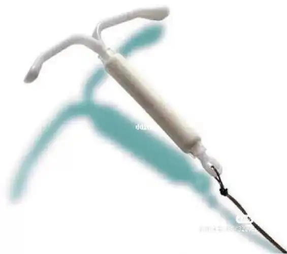 因为子宫内膜息肉已经做过三次宫腔镜手术了,医生建议放置曼月乐环,看