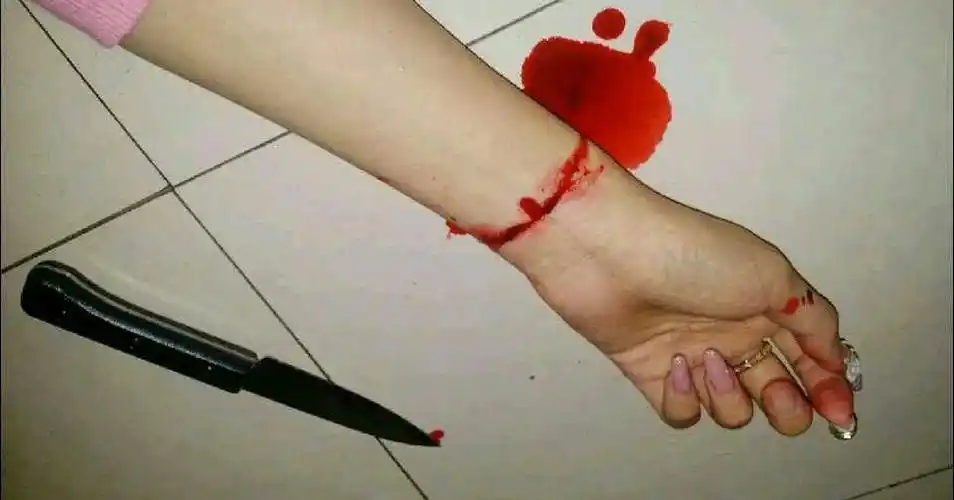 自残个手指 自残剁手指疼