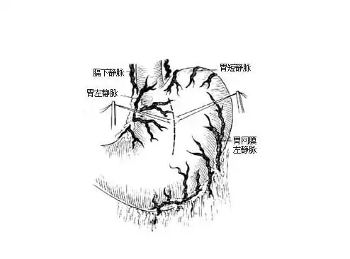 按血管的构造功能不同,分为动脉,静脉和毛细血管三种.