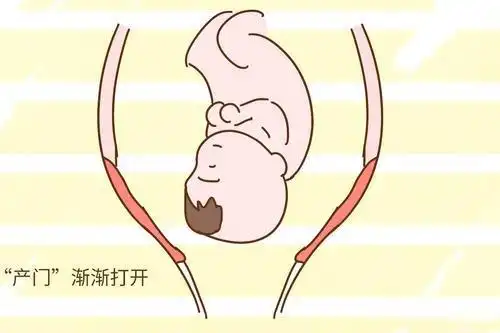 子宫下段存在的肌瘤或者宫颈水肿等,也可以影响宫口开放的速度