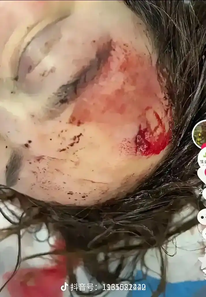 刚看到时候,突然觉得好气愤,气死了,但是我突然脑袋里有一个想 - 抖音