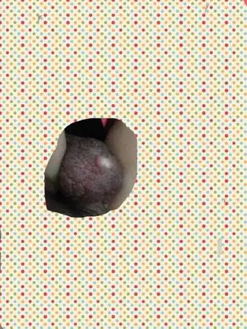 成都催乳师林老师:昨天两个宝妈的胀奶问题