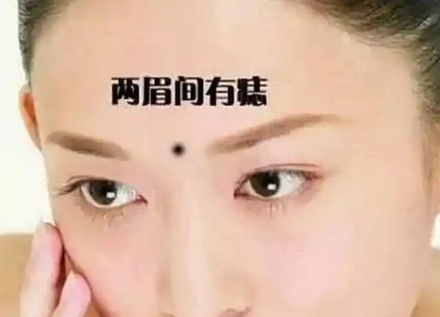 女人脸上这5个地方长痣多为克夫婚姻不顺
