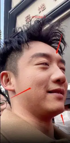 郑恺怼脸照片暴露皮肤状态,有闭口细纹多还卡粉,网友:该补水了