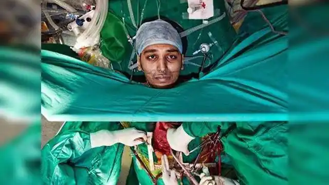 手术切除死者器官,死者却突然睁眼,吓坏医生!