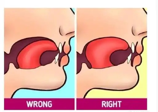 我在微博涨见识#舌头的正确摆放位置你舌头平时是怎么摆放的?