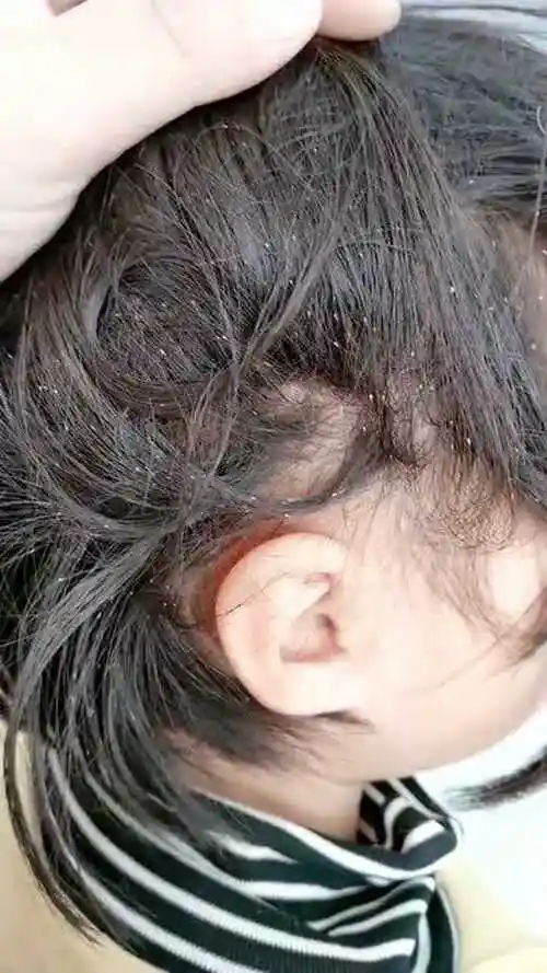 婆婆真行孩子头上长虱子也不给洗洗难不成等着我动手洗吗