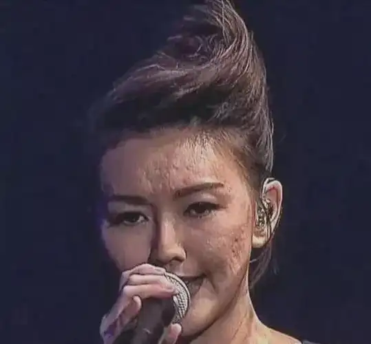 孙燕姿:童年女神究竟遭遇了什么,居然面目全非了