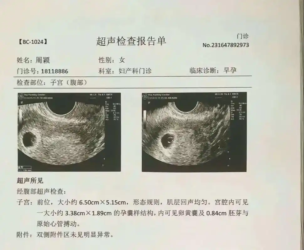 好搞笑,好好玩假的这单子搞的和真的一样#恶搞怀孕b超报告单# - 抖音